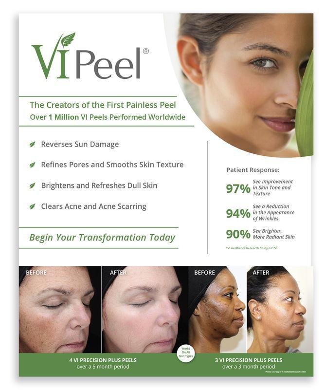 VI Peel ad